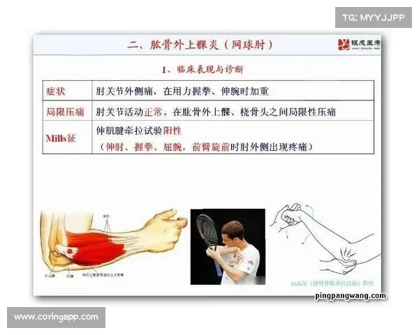 网球比赛中的常见伤病分析及预防措施探讨 网球比赛中的常见伤病分析及预防措施探讨
